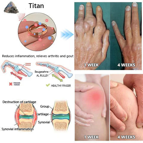 CZTICLE magnetic therapy ring made of titanium steel with natural diamond 🔥 Buy more, save more 🔥🔥